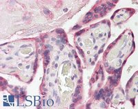 EB08321 3