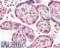 EB10143 1