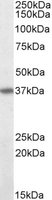 EB09626 1