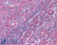 EB06491 2