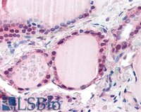 EB07392 2