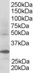 EB06064 1