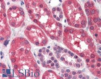 EB06649 3