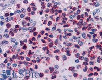 EB06394 2