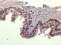 EB05999 1
