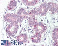 EB05999-T 2