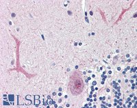 EB06006-T 4