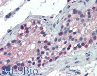 EB06011 2