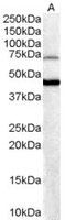 EB05608-T 1