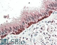 EB09743 1