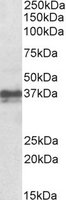 EB10760 1