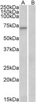 EB06392-T 1