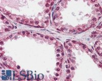 EB07520 2