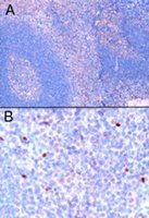 EB05294 5