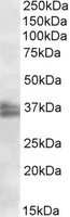 EB09931 1