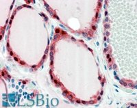 EB08353 3
