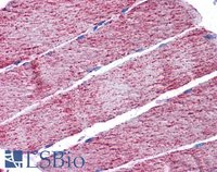 EB07874 3