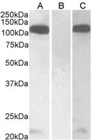EB11526 1