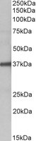 EB10981 1