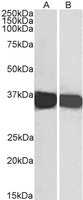 EB06377-T 6