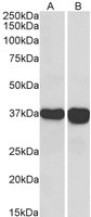 EB06377-T 5