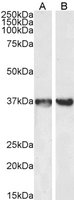 EB06377-T 4