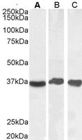 EB07069-T 1