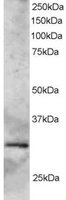 EB05705 1