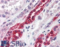 EB06885 1