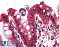 EB06876 2