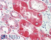 EB11795 3