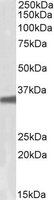 EB10456 1