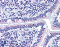 EB05667 2