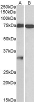 EB10558 1
