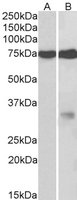 EB10558 2