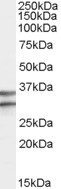 EB07945 1