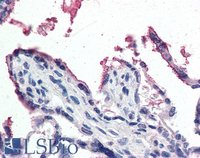 EB07685 2