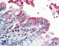 EB07685 3
