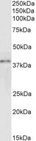 EB05113 2