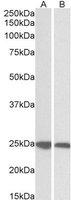 EB05284 2