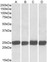 EB05284-T 3