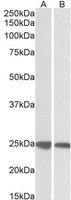 EB05284-T 2