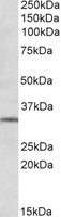 EB10214 1