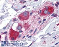 EB05631 3