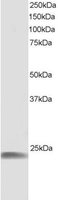EB05677-T 1