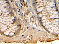 EB06904 2