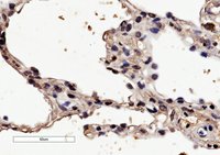 EB07699 2