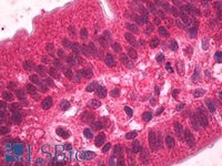 EB06700 3