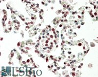 EB12202 1