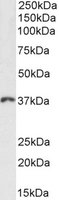 EB09834 1